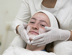 Acne behandeling