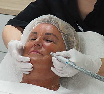 Dermabrasie