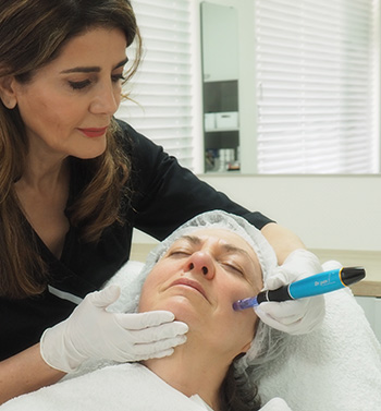 Microneedling