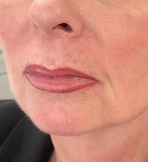 Permanente makeup - Lippen